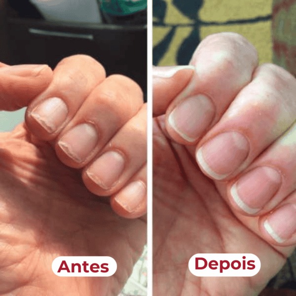 Antes e depois mostrando unhas mais resistentes com Belli K Pelle