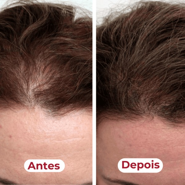 Antes e depois mostrando cabelo mais forte com Belli K Pelle